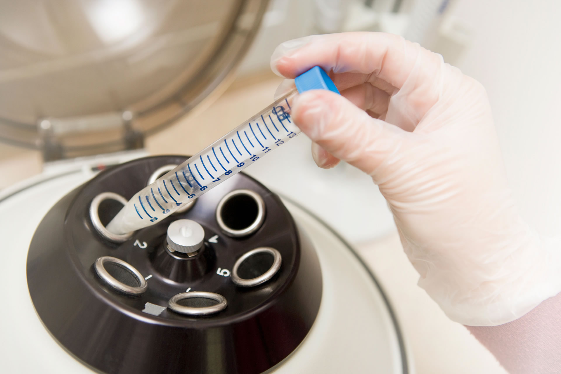Mano di un tecnico di laboratorio che inserisce una provetta etichettata con spermatozoi preparati in una centrifuga per il trattamento del seme maschile prima di una procedura di inseminazione intrauterina (IUI)